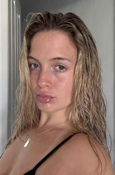 Hanne, 34 år